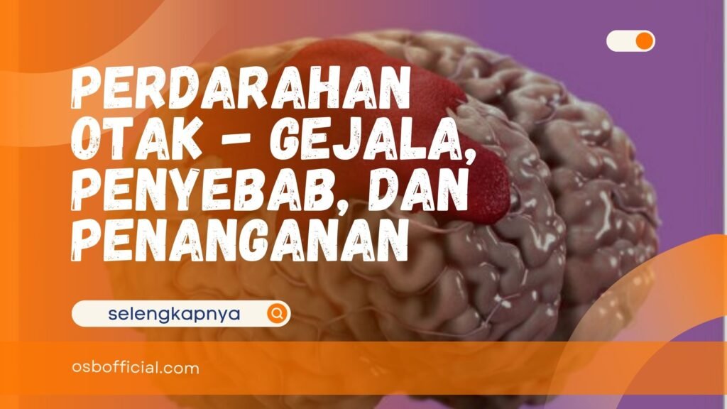 Perdarahan Otak