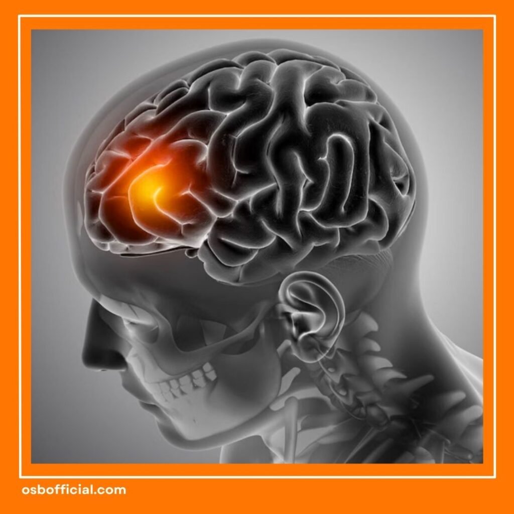Radang Otak dan Abses Otak
