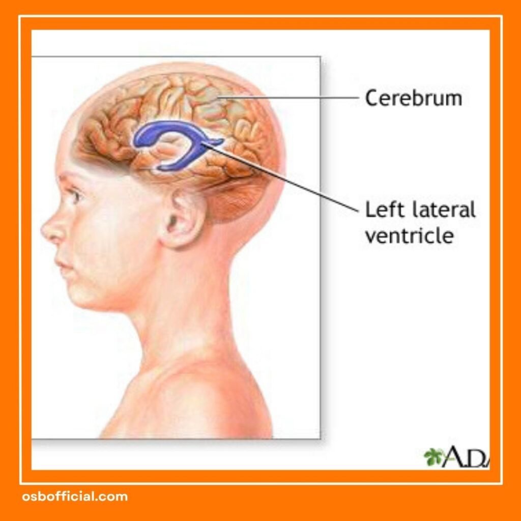 Mengenal Ventrikel Otak