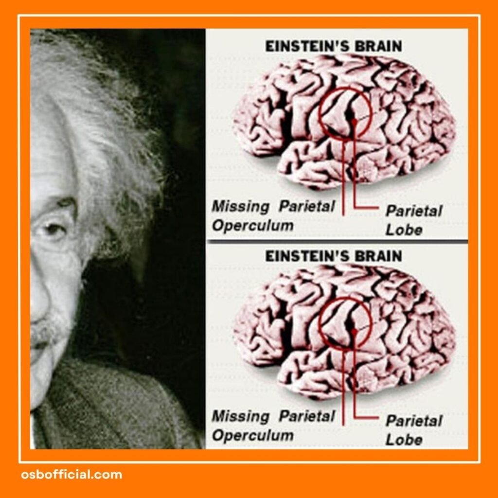 Otak Einstein